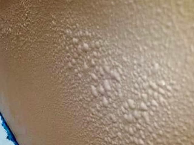 浮きや剥がれが生じた外壁の塗膜